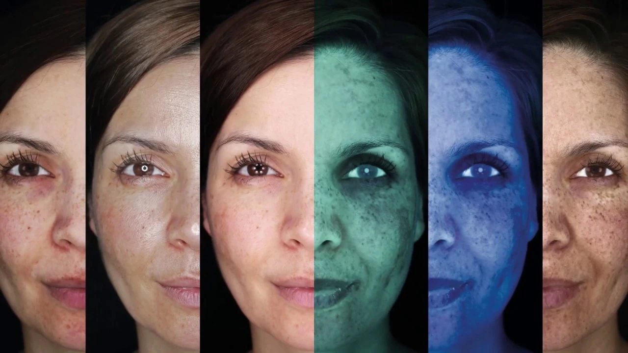 Facial views under different skin analysis lighting