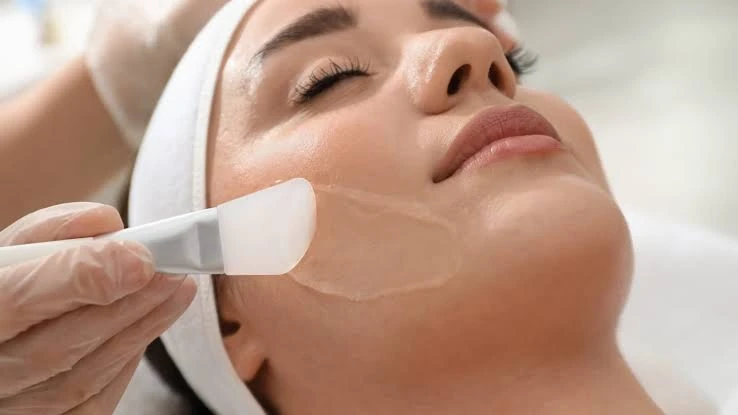 Chemical peel being applied to the face