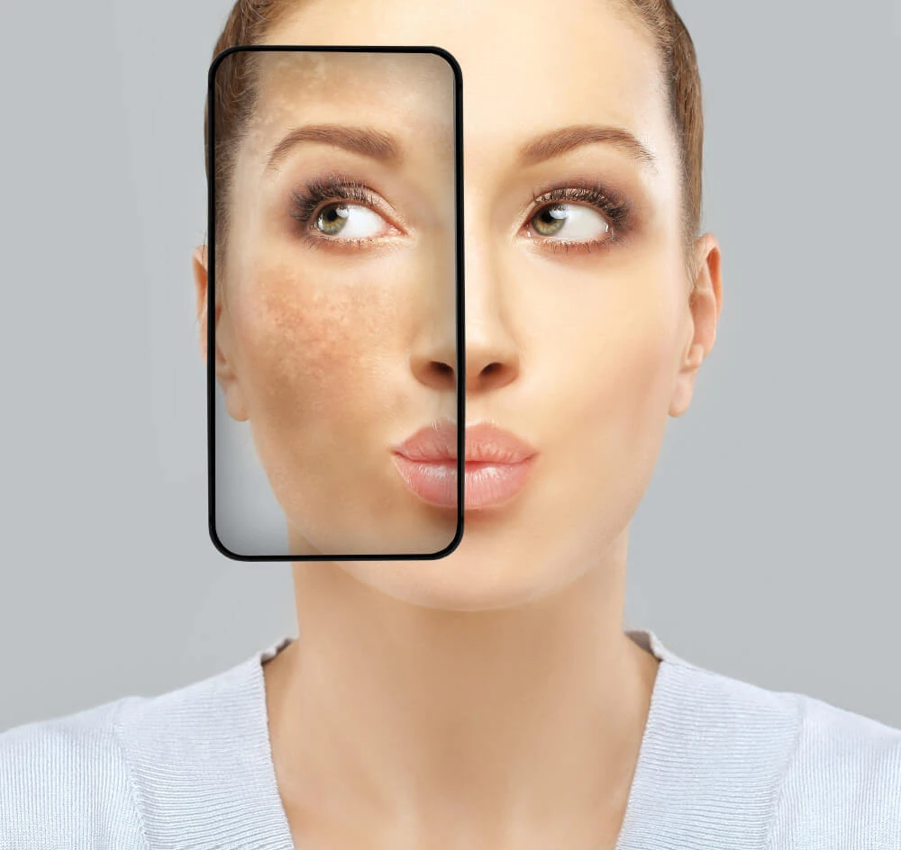 Illustration comparing uneven and even facial pigmentation