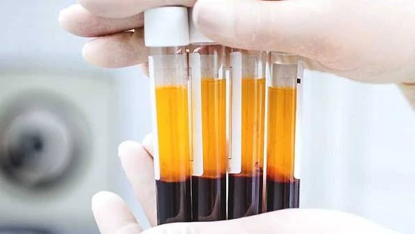 Separated blood components in PRP tubes