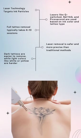 Laser tattoo removal technology infographic